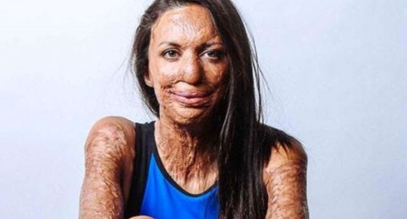Australian athlete and author Turia Pitt, author of Selfish.