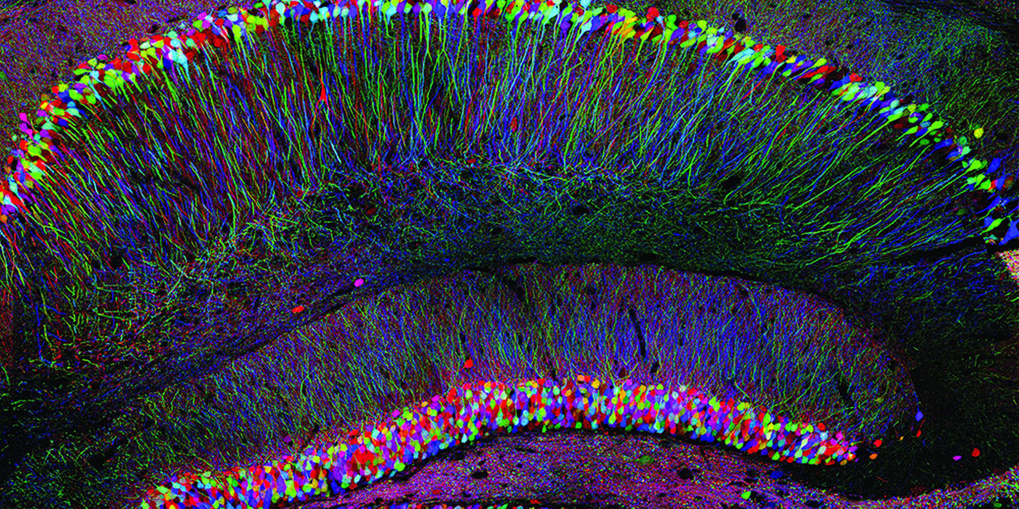 Image of mind uploading