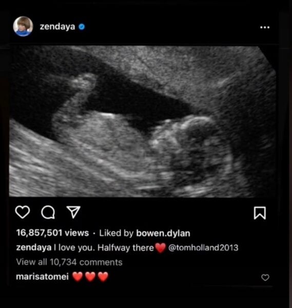 Zendaya pregnant