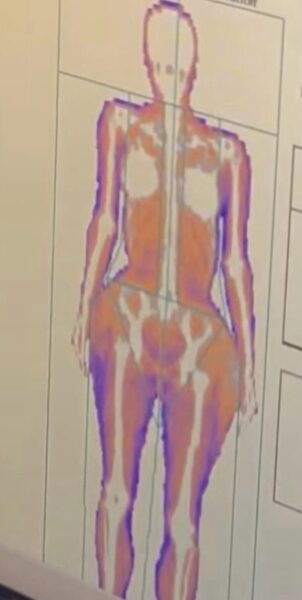 Kim Kardashian's body scan