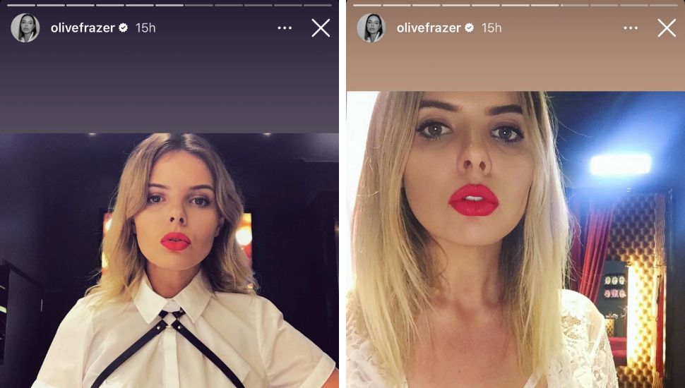 Olivia Frazer shows pre filler lips again