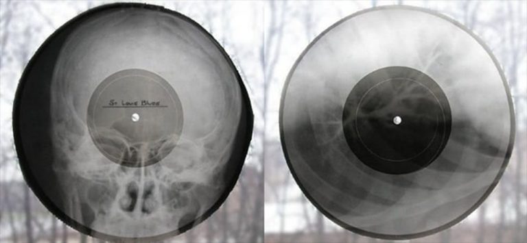 Soviet vinyl made out of x-rays