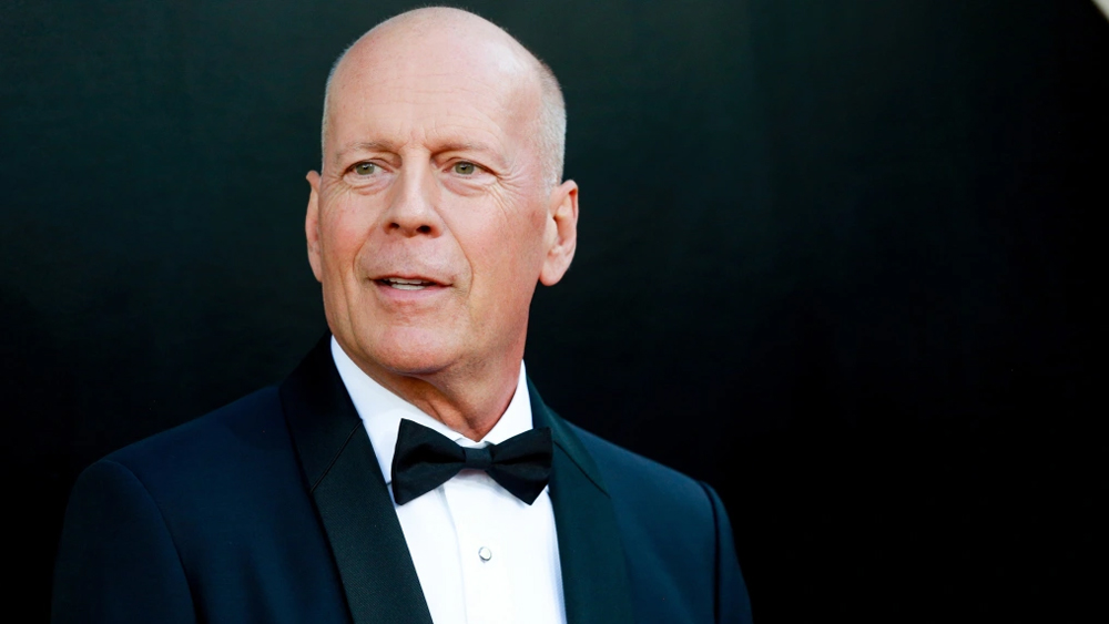 Bruce Willis Diagnosed With Dementia After